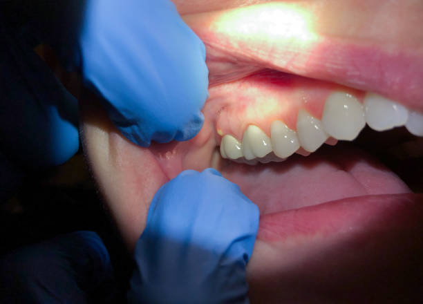 Best Cracked Tooth Emergency Dentist  in St James, NC